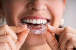 A woman holding a clear aligner.