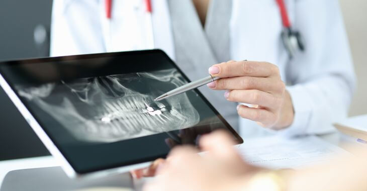 A dentist discussing dental x-rays with his patient.