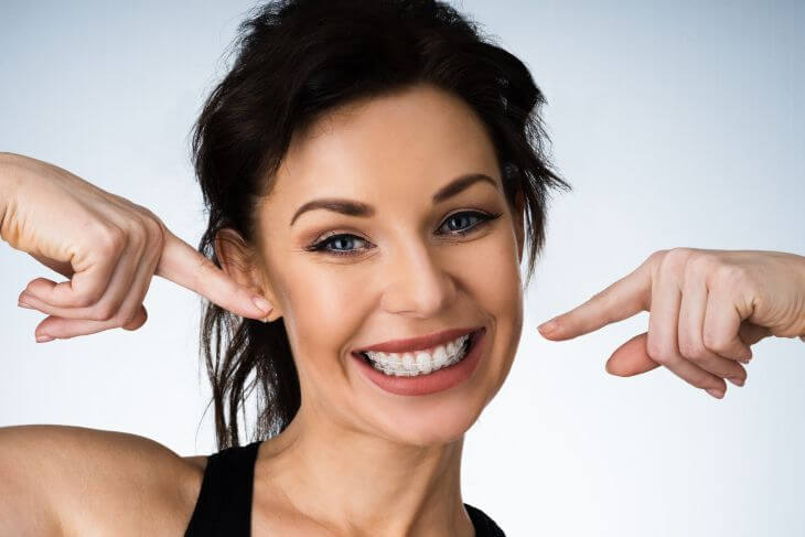 A smiling young woman wearing dental braces pointing at her teeth.