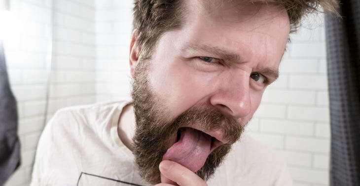 A man looking at his scalloped tongue in the mirror.