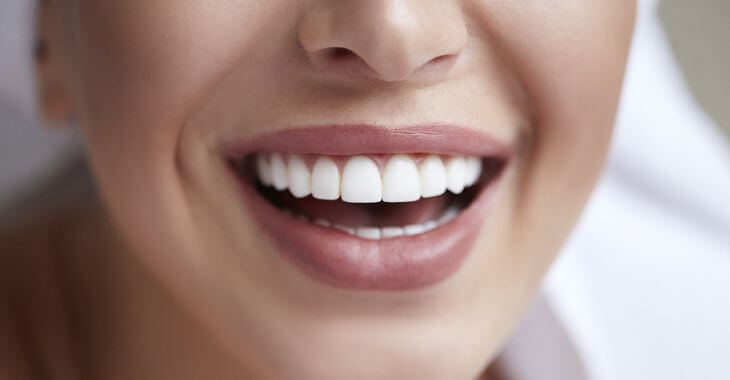 Woman after dental veneers cosmetic treatment showing her perfect teeth in her smile. 