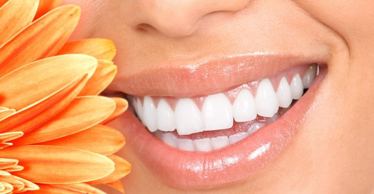 Woman showing perfect teeth after teeth whitening treatment in her smile.