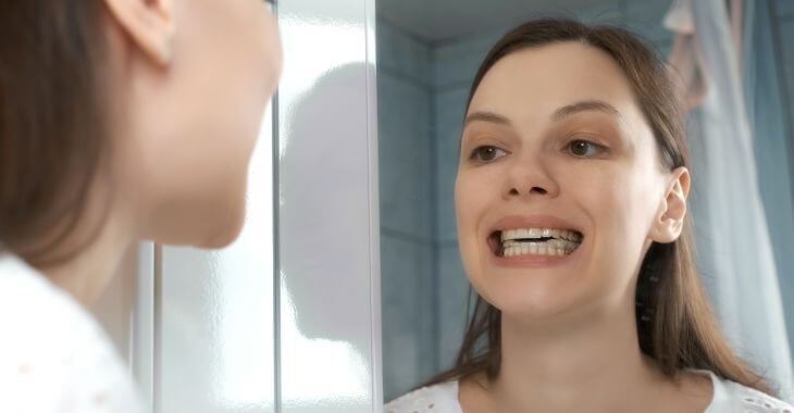 A teenage girl wearing a retainer to correct open bite teeth.