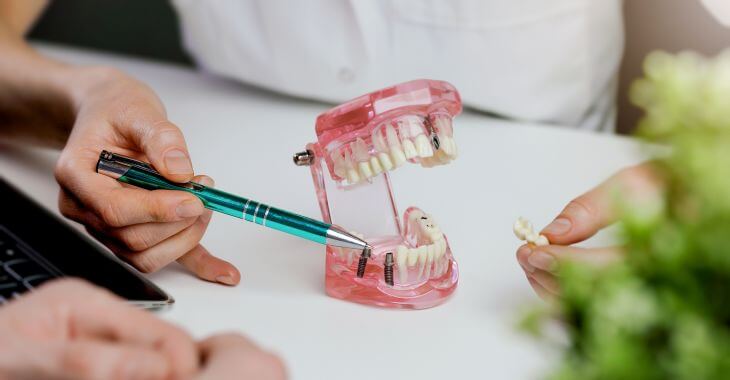Dentist explaining back missing teeth replacement treatment on a dental model.