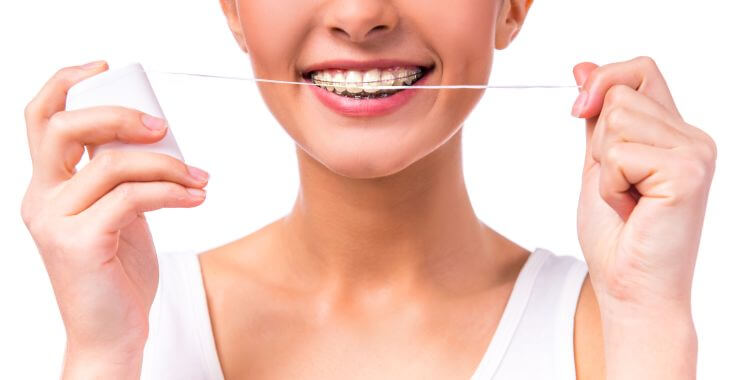 Woman wearing orthodontic braces flossing her teeth.